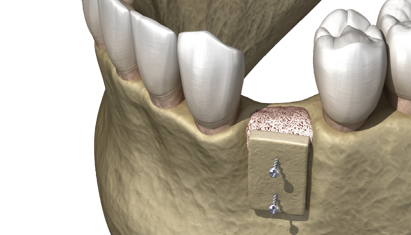 Odontoiatria conservativa